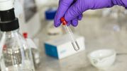 Pracownik laboratorium trzyma probówkę z cieczą, nosi fioletowe rękawice ochronne.