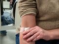Na zdjęciu widoczna jest ręka z bandażem, osoba dotyka bandażu, w tle inni ludzie.