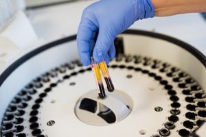 Ręka w niebieskiej rękawicy trzyma dwie probówki krwi nad wirówką laboratoryjną.