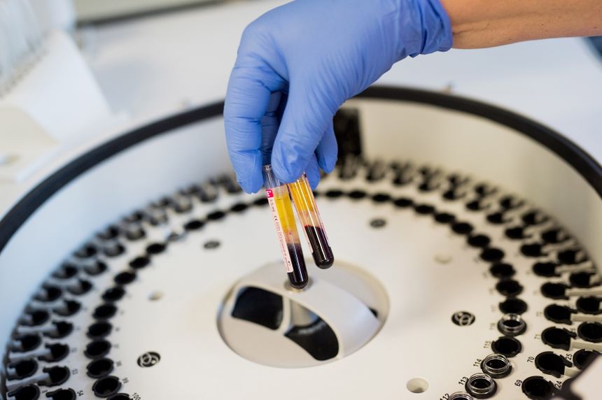 Ręka w niebieskiej rękawicy trzyma dwie probówki krwi nad wirówką laboratoryjną.
