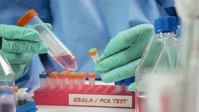 Pracownik laboratorium wykonuje test PCR, trzymając próbówki z próbkami.